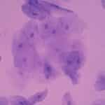 cellule epitheliale 1