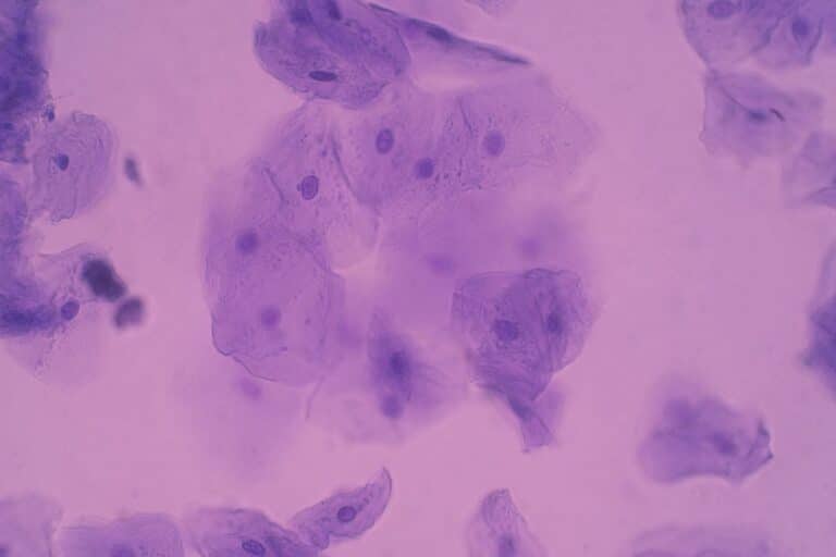 cellule epitheliale 1