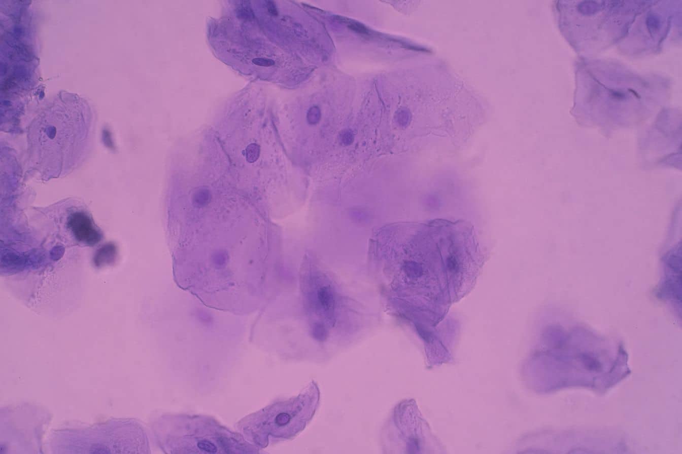 cellule epitheliale 1