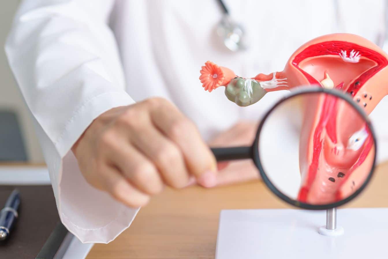 fibrome menopause 1