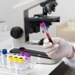 test candidose 1