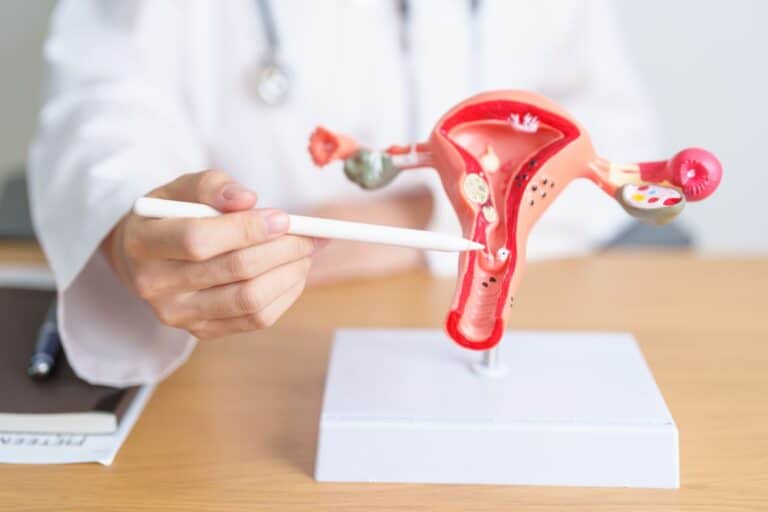 un fibrome calcifie peut il grossir 1